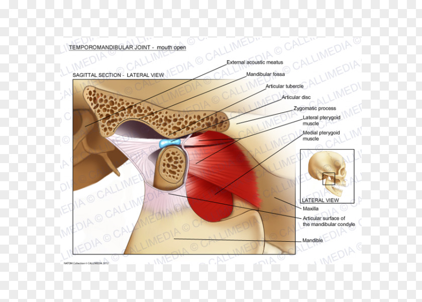 Skull Temporomandibular Joint Dysfunction Anatomy Mandible PNG