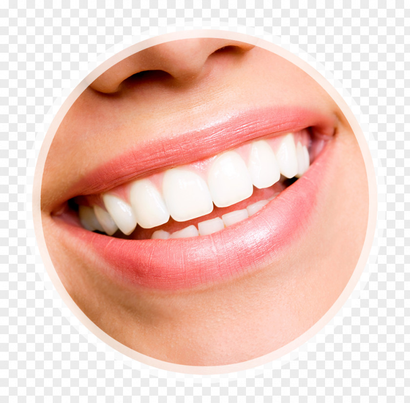 Coffee Stains Teeth Veneer Tooth Whitening Human Dentistry PNG