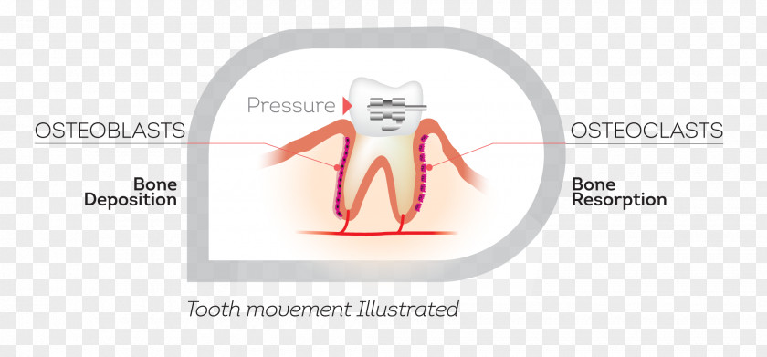Movement Orthodontics Jaw Tooth Therapy Brand PNG