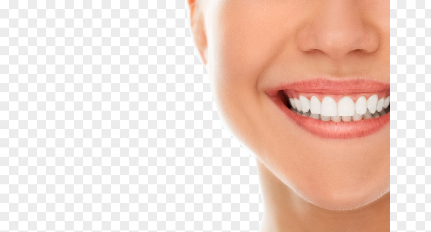 Dentistry Oral Hygiene Dental Implant Public Health PNG hygiene implant public health, Teeth model, woman smiling clipart PNG
