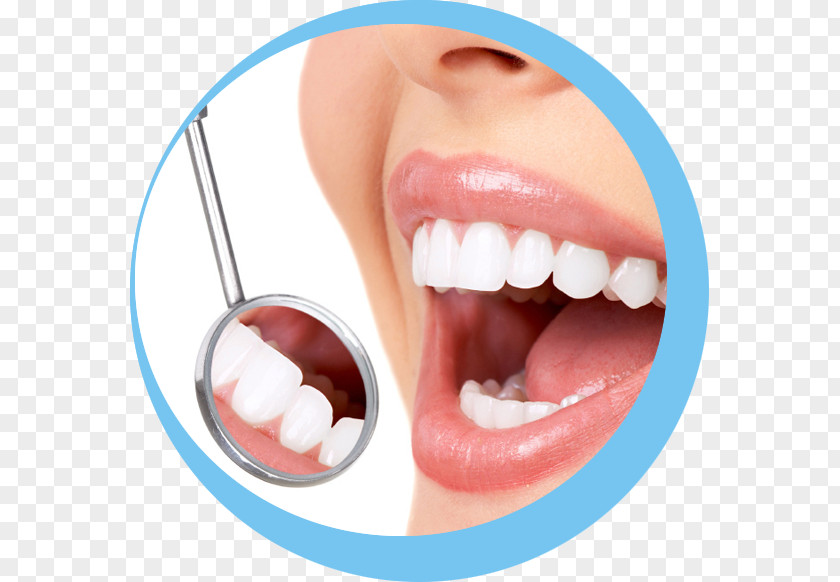 Dentistry Cosmetic Dental Restoration Tooth Decay PNG