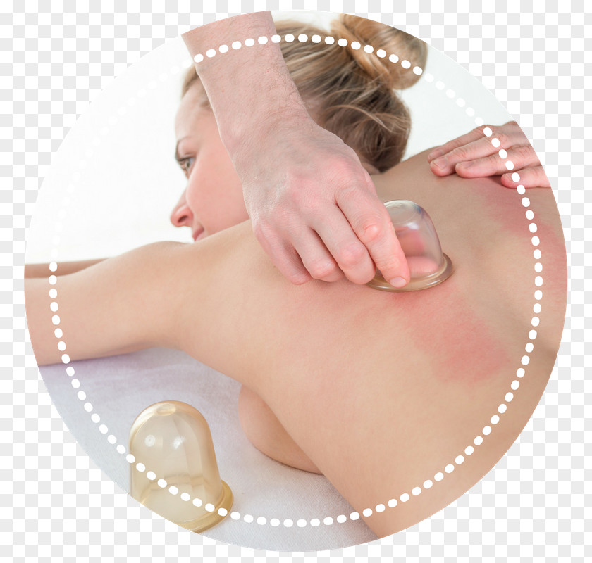 Cupping Therapy Alternative Health Services Bekam Medicine Massage PNG