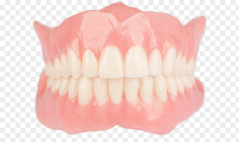 Bridge Tooth Dentures Dentistry Dental Laboratory PNG