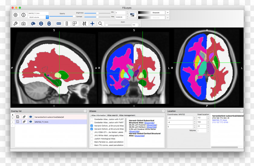 Brain University Of Oxford Atlas The World Look At Press PNG