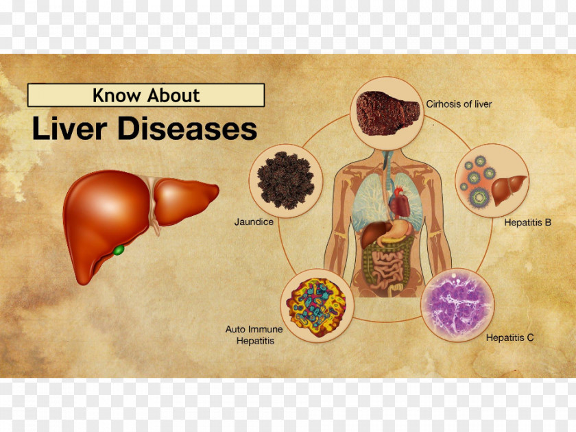 Health Medicine Therapy Capsule Disease PNG