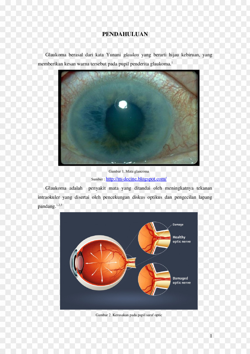 Gambar Target Close-up Optic Nerve PNG