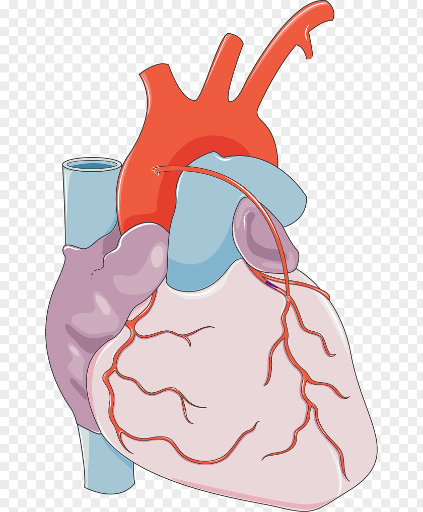 Heart Myocardial Infarction Cardiology Coronary Artery Disease Cardiovascular PNG