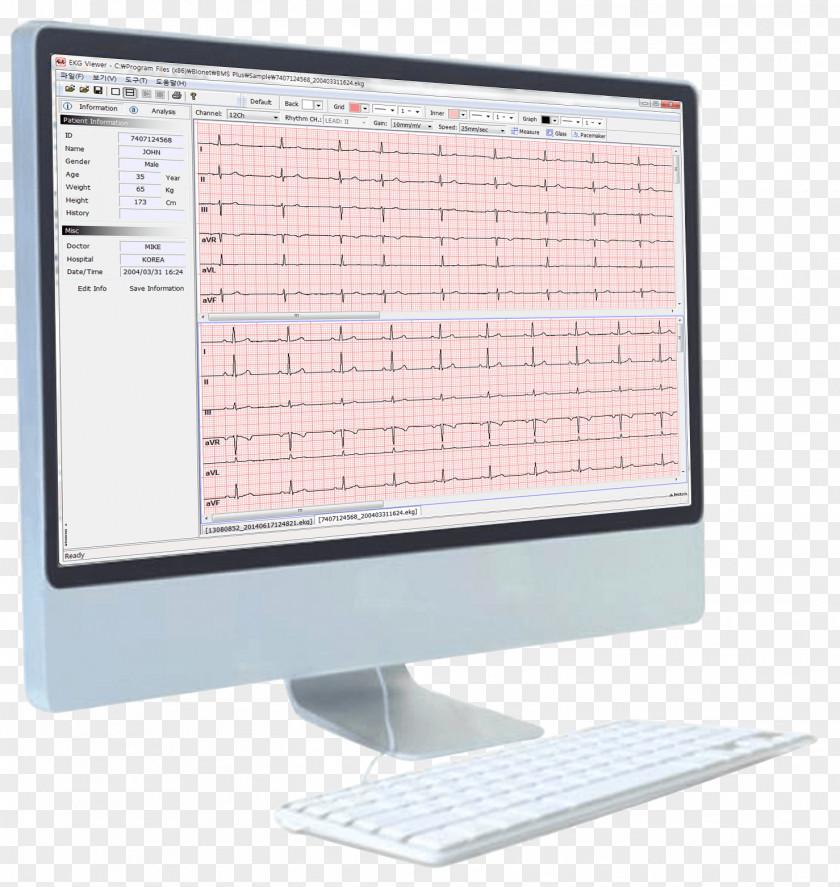 Pulmonary Function Testing Artun Medikal Teknik Servis Electrocardiography Spirometer Vital Capacity PNG