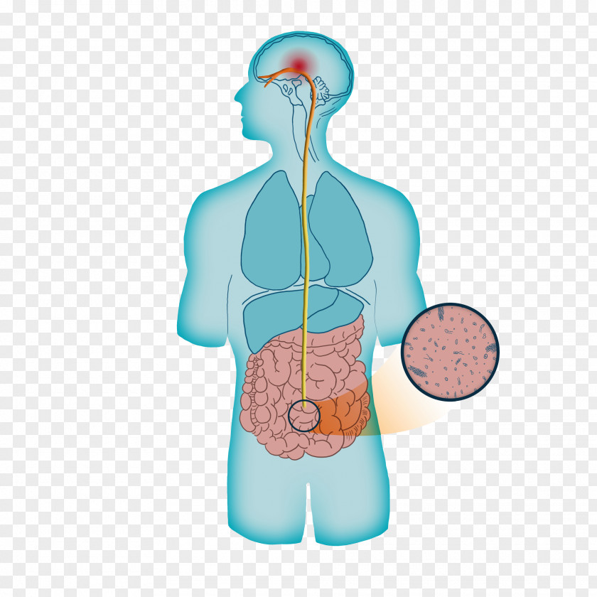 Gut Brain Axis Royalty-free Anxiety Disorder Parkinson Disease Dementia Depression PNG