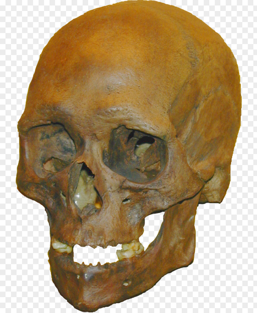 Skull Tautavel Man Stellmoor Homo Sapiens Meiendorf PNG
