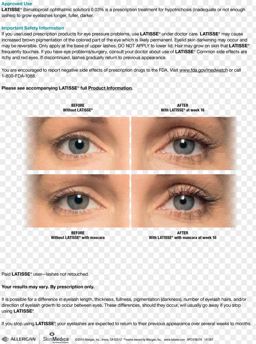 Aesthetics Bimatoprost Medicine Eyelash Dermatology Physician PNG