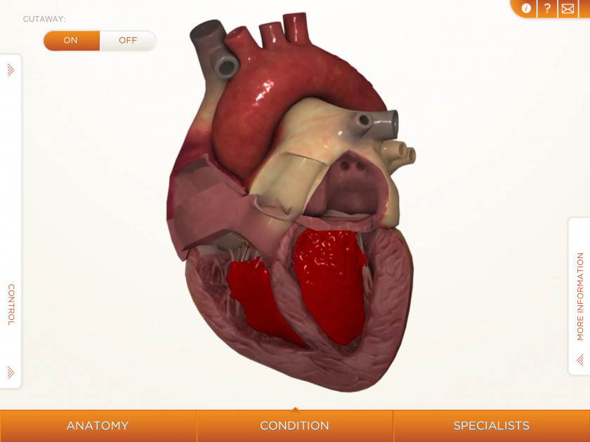 Heart Pictures Cardiovascular Disease Human Body Anatomy Muscle PNG