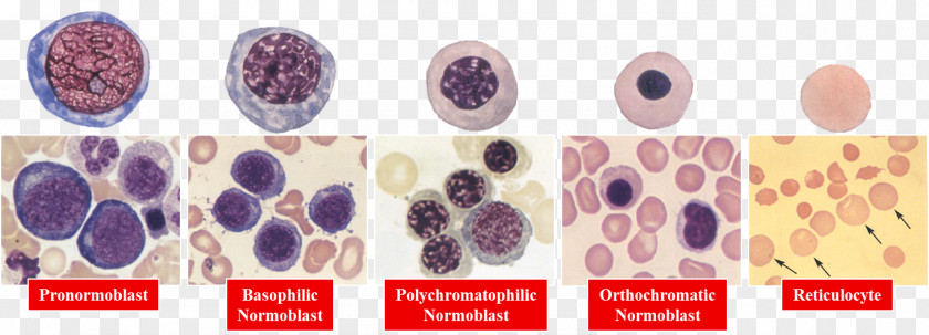 Multiple Myeloma Erythropoiesis Red Blood Cell Hematology Neutrophil Haematopoiesis PNG