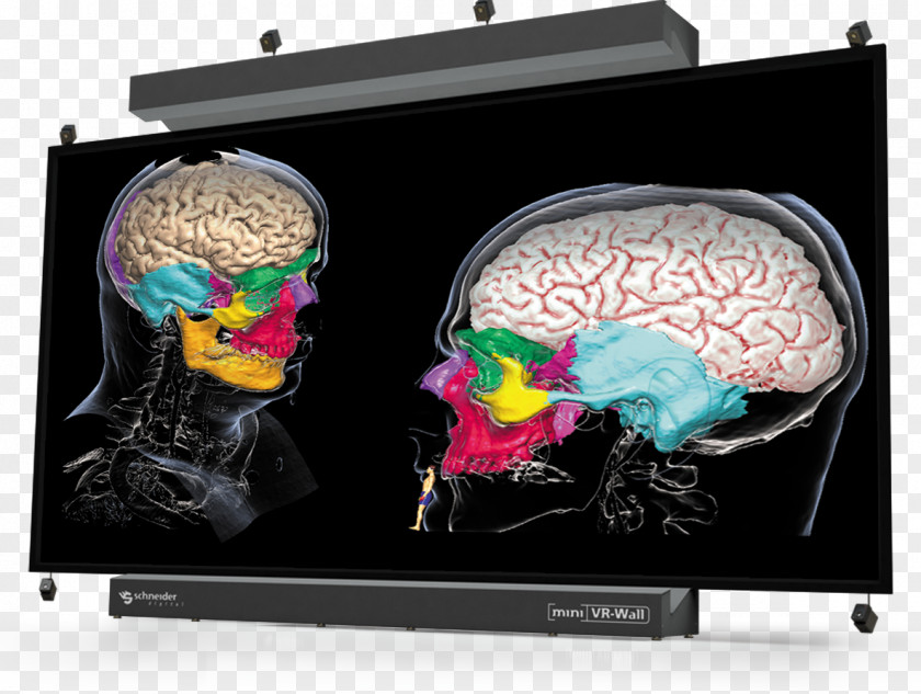 Brain Display Device PNG