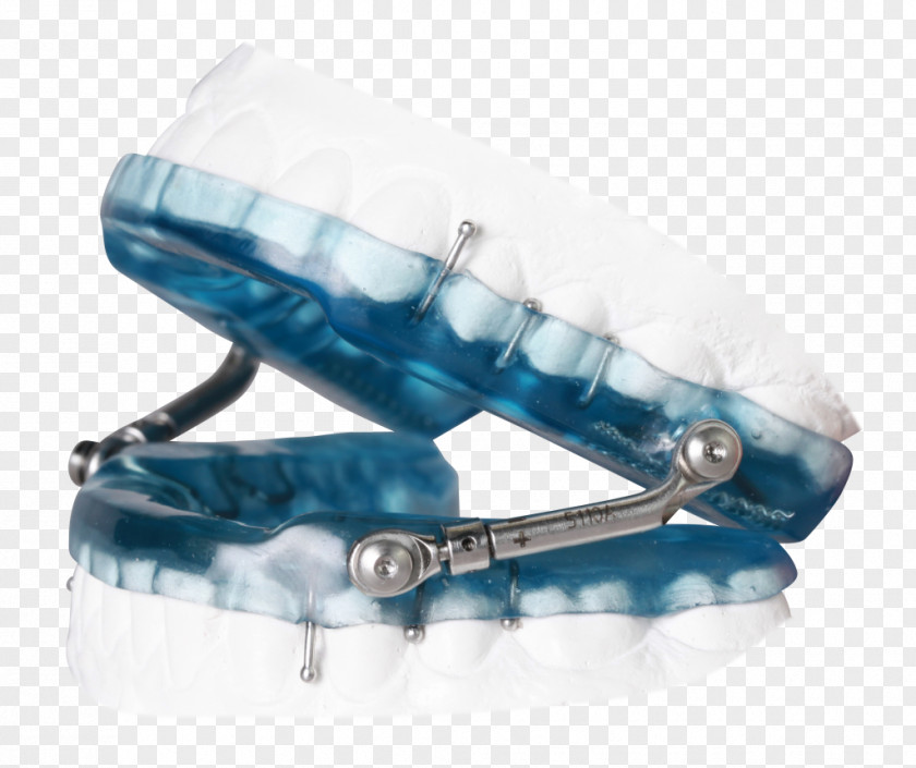 Snoring Obstructive Sleep Apnea Mouthguard Mandibular Advancement Splint Dentistry PNG