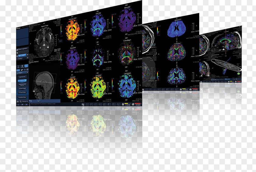 Technology Magnetic Resonance Imaging Toshiba Canon Medical Systems Corporation MRI-scanner PNG