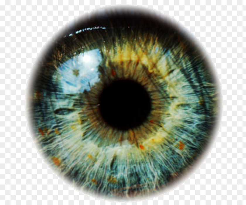 Eye Human Blepharitis Color PNG