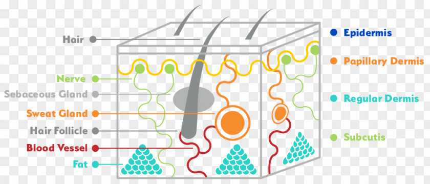 Skin Cancer Basal-cell Carcinoma Stratum Basale PNG