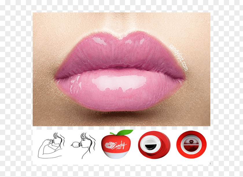 Lip Finger Augmentation Cosmetics Face Restylane PNG
