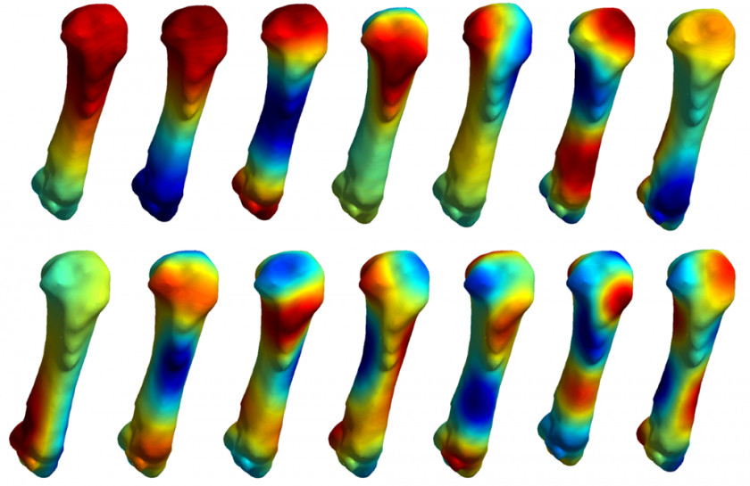 Musculoskeletal Pictures Human System Carpal Bones Disorder Research PNG