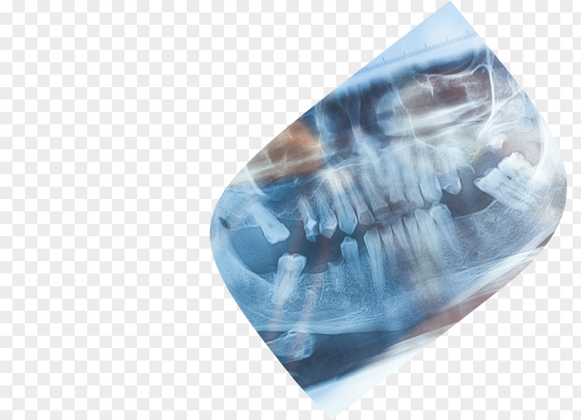 Orthodontist Dentistry Tooth Dental Implant Orthodontics PNG
