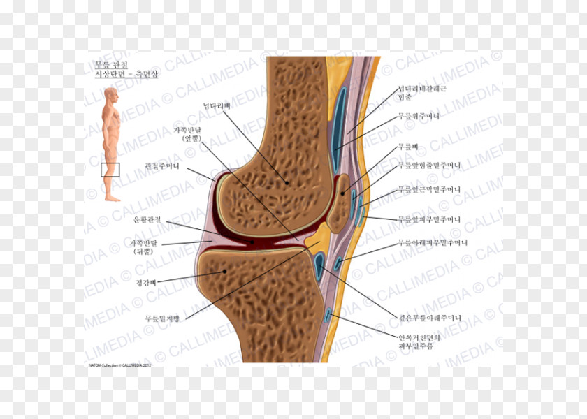 Artrosis De Rodilla Prepatellar Bursitis Synovial Bursa Infrapatellar Knee PNG