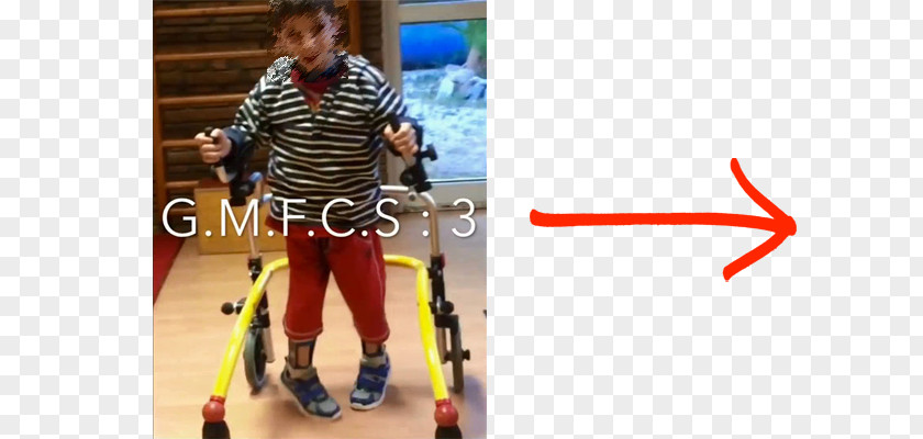 Child Cerebral Palsy Physical Therapy Gross Motor Function Classification System Brain PNG