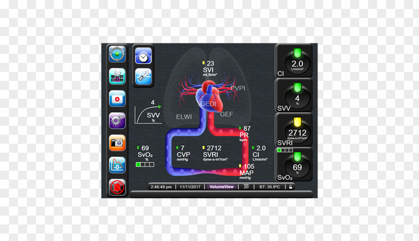 Physiology Display Device Cardiac Output Stroke Volume PNG