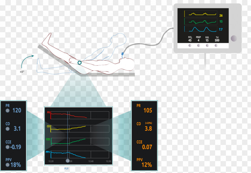 Marker Stroke Vytech S.r.l. Hemodynamics Vygon Italia Srl MostCare Social Media PNG