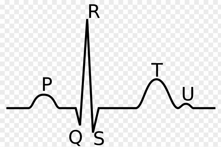 Ecg QRS Complex Electrocardiography P Wave Heart Depolarization PNG