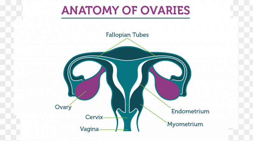 Ovary Ovarian Cancer Fallopian Tube Tumor PNG