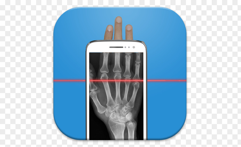 Android Xray Scanner Prank X-ray Practical Joke Image PNG