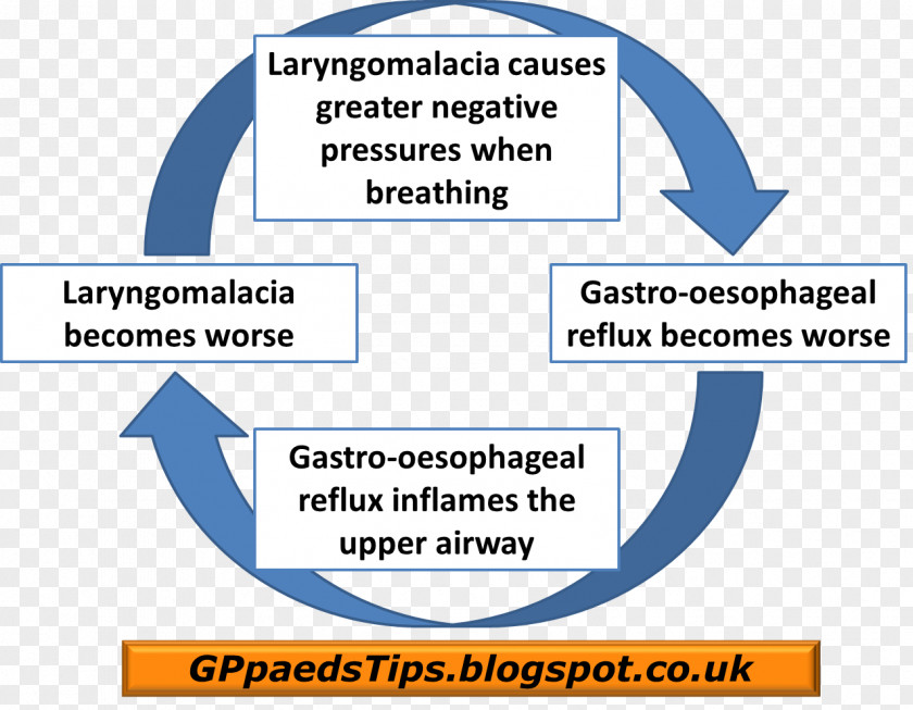 Child Laryngomalacia Gastroesophageal Reflux Disease Infant Patient PNG
