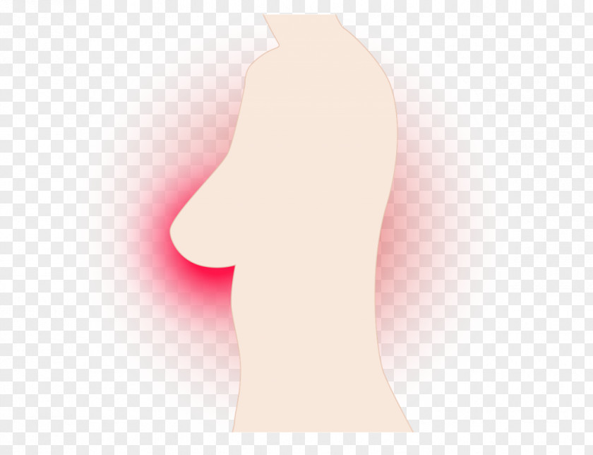 Triple-negative Breast Cancer Ovarian PNG breast cancer cancer, clipart PNG