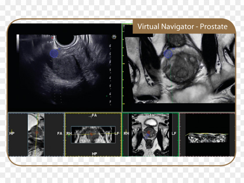 Ultrasonography Magnetic Resonance Imaging Esaote Medical Equipment PNG