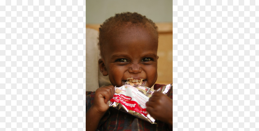 Post Production Infant Malnutrition Child Health Mortality Rate PNG