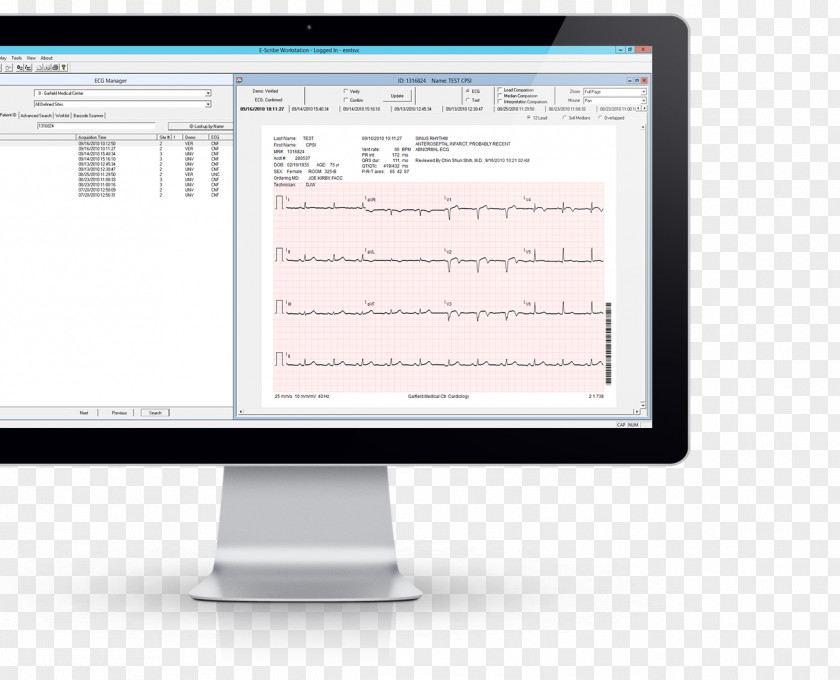 Electrocardiography Information Welch Allyn CPR-UI-UB-D PC-Based Resting ECG Interpretive Software ABPM-6100S Cardioperfect 6100-Series ABPM Management PNG