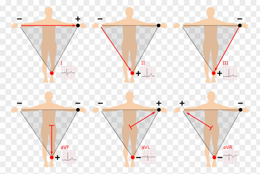 Practical Vector Electrocardiography 12-Lead ECG: The Art Of Interpretation 3-Lead EKG Einthoven's Triangle Heart PNG