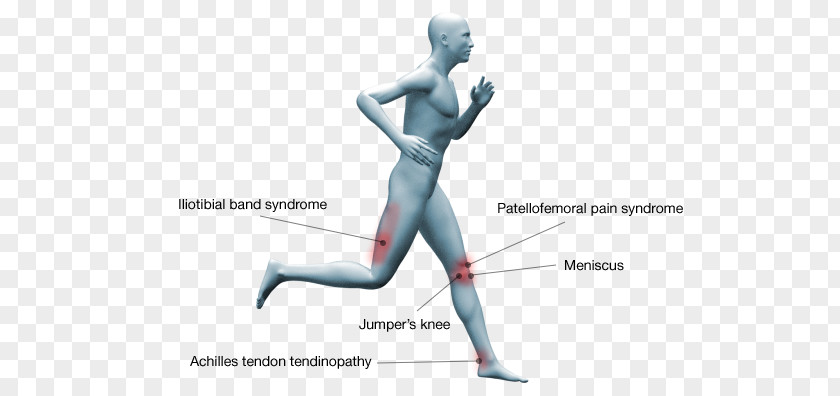 Running Injuries Walking Achilles Tendon Finger PNG