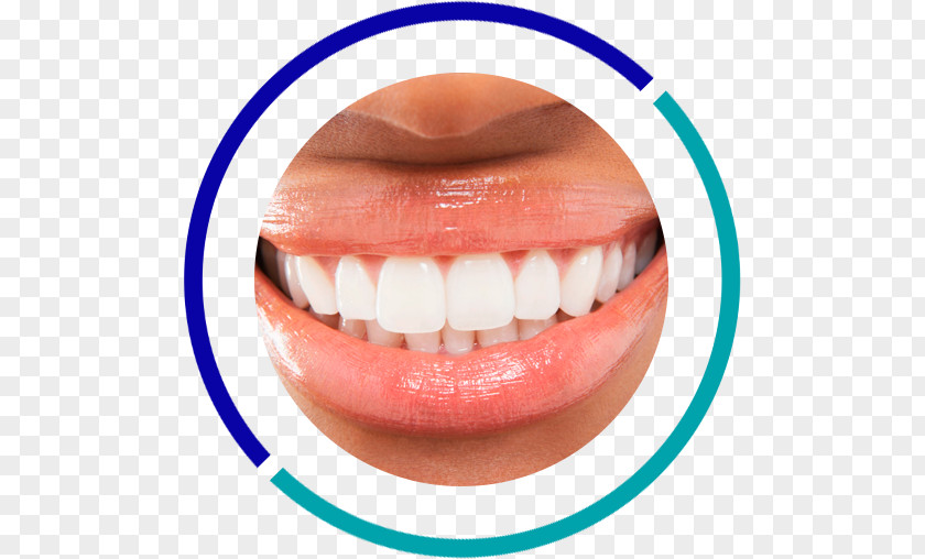 Cosmetic Dentistry Tooth Whitening Human PNG