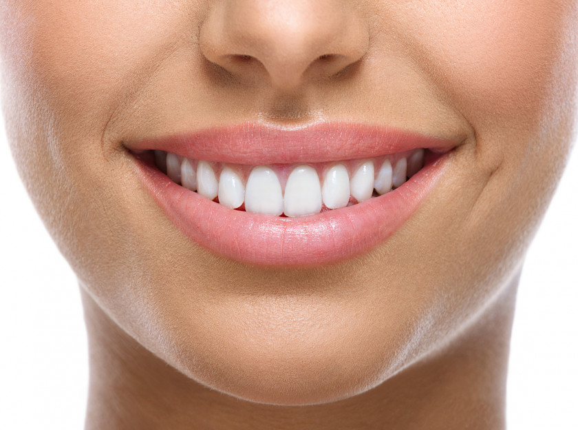 Teeth Tooth Whitening Cosmetic Dentistry Smile PNG