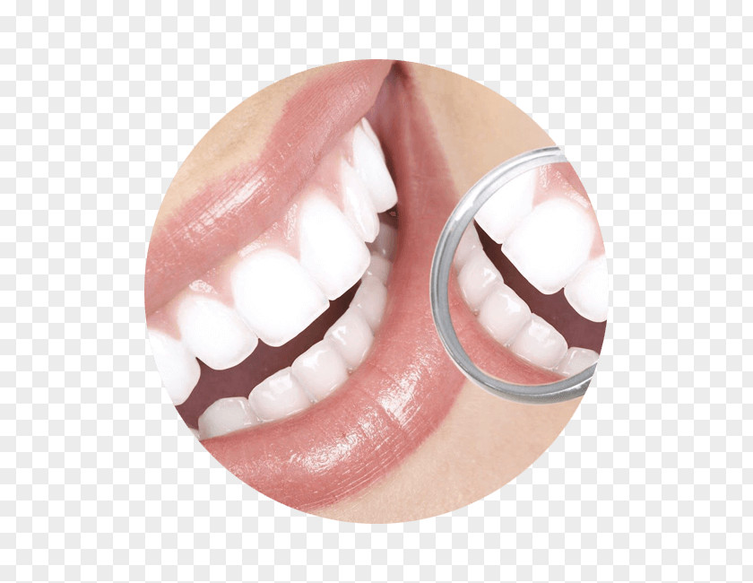 Restorative Dentistry Cosmetic Tooth Periodontology PNG