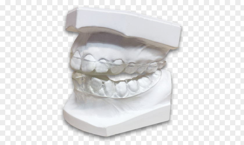Dental Laboratory Jaw Tooth Bruxism Dentistry Splint PNG