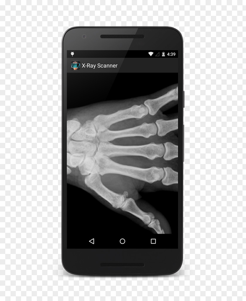 Smartphone Nailbiters X-ray Scanner Prank IPhone X Android PNG