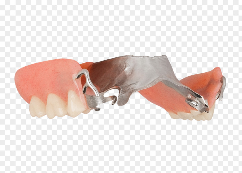 Aspen Dental Thumb Shoe PNG