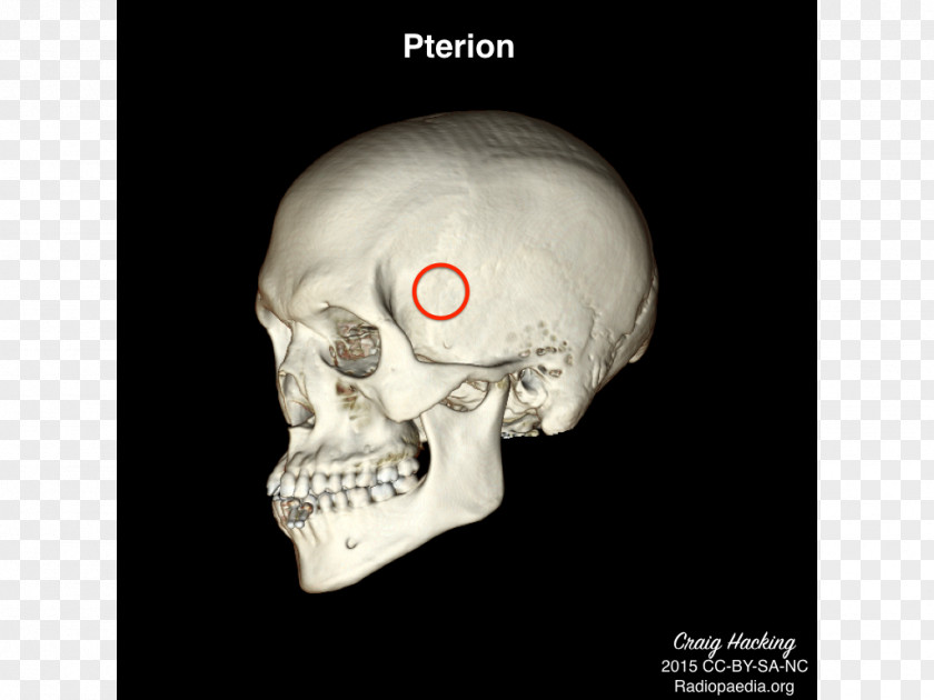 Skull Anatomy Physical Therapy Health PNG