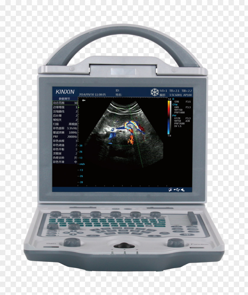 Ultra Sound Ultrasonography Ophthalmology Equine Ultrasound Doppler Echocardiography PNG