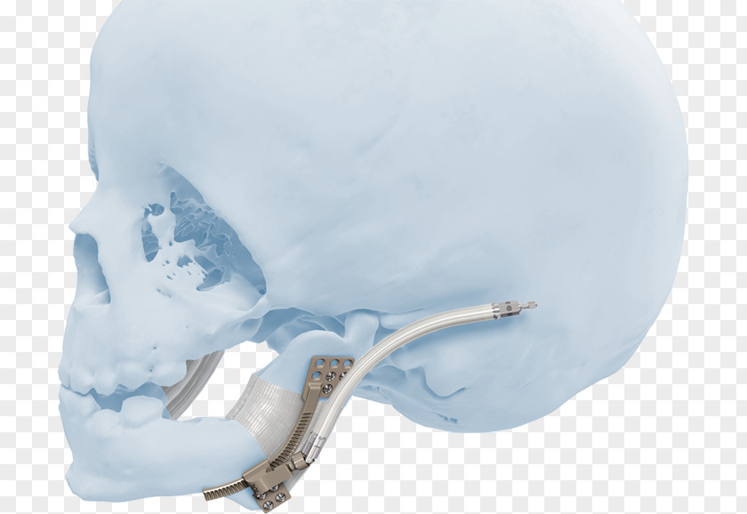 Skull Product Design Ice PNG