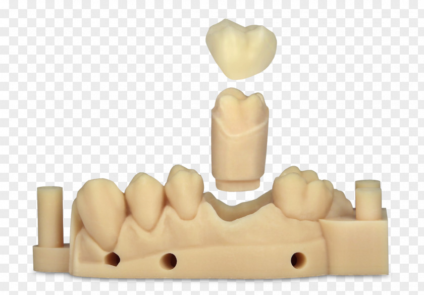 Crown Dentistry EnvisionTEC 3D Printing PNG