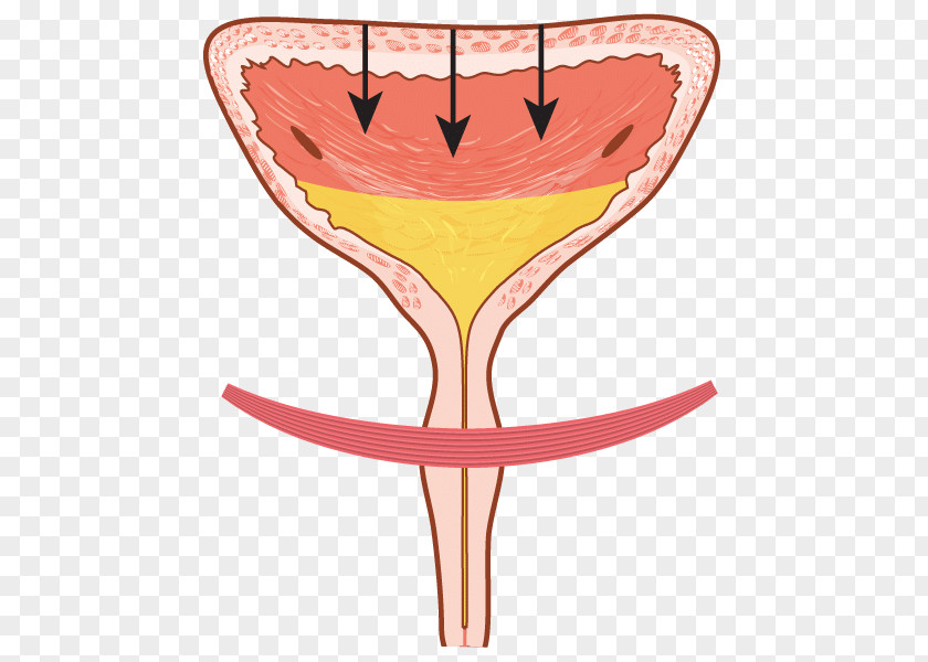 Overactive Bladder Urinary Incontinence Retention Urination PNG